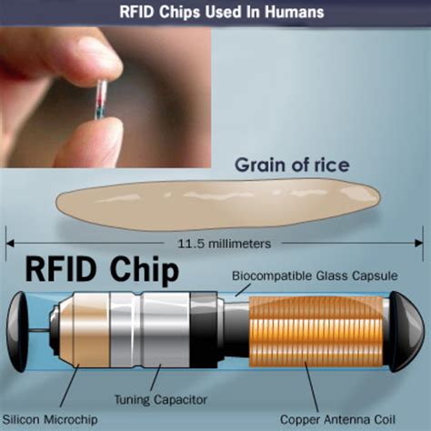 can rfid chip be removed|rfid chip detector.